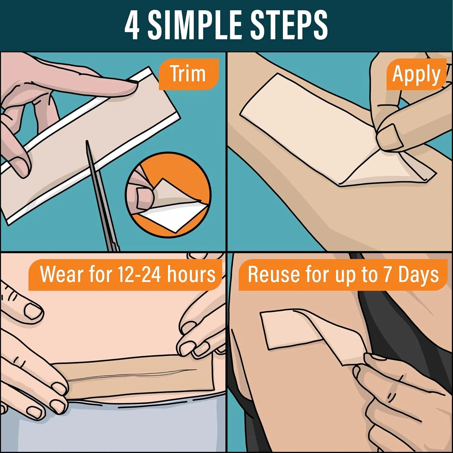 NUVADERMIS Silicone Scar Tape for Surgical Scars - 120" x 1.5" Roll - Extra Long Medical Grade Silicone Scar Tape for C-Section, Tummy Tuck, Keloid, and Surgical Scars - Reusable Tape Strips - 1 Pack