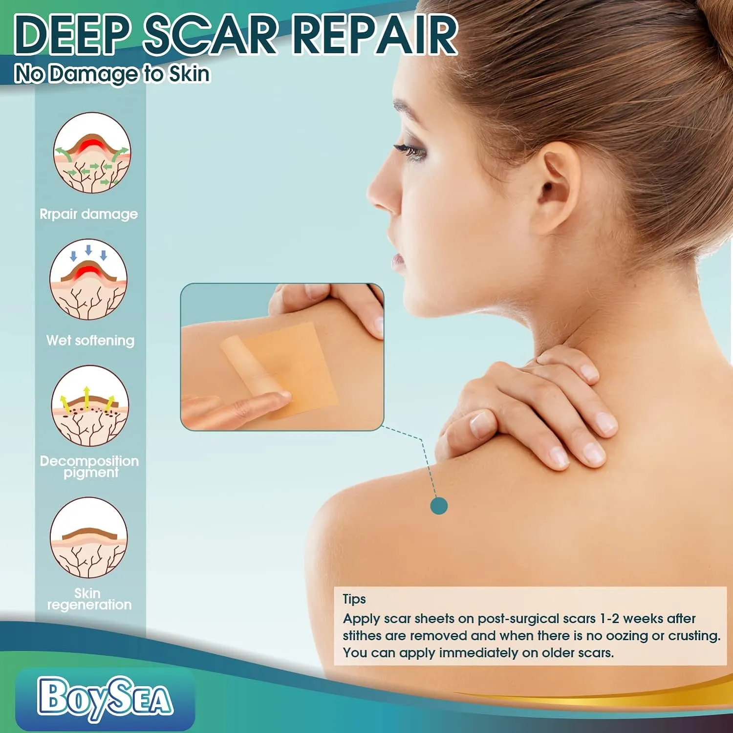 Professional Silicone Scar Sheets (1.6" x 150" Scar Roll-3.8M) - Scars Removal Treatment - Reusable Silicone Scar Tape Strips Type for Keloid, C-Section, Surgery, Burn, Acne et
