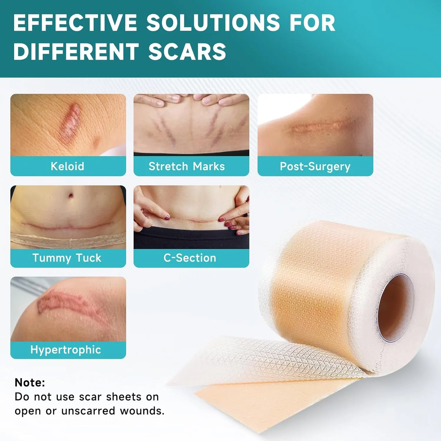 Silicone Scar Sheets, Silicone Scar Tape(1.6” x 120” Roll-3M), Scar Removal Away Strips for Surgical Scars, Keloid, C-Section, Burn et