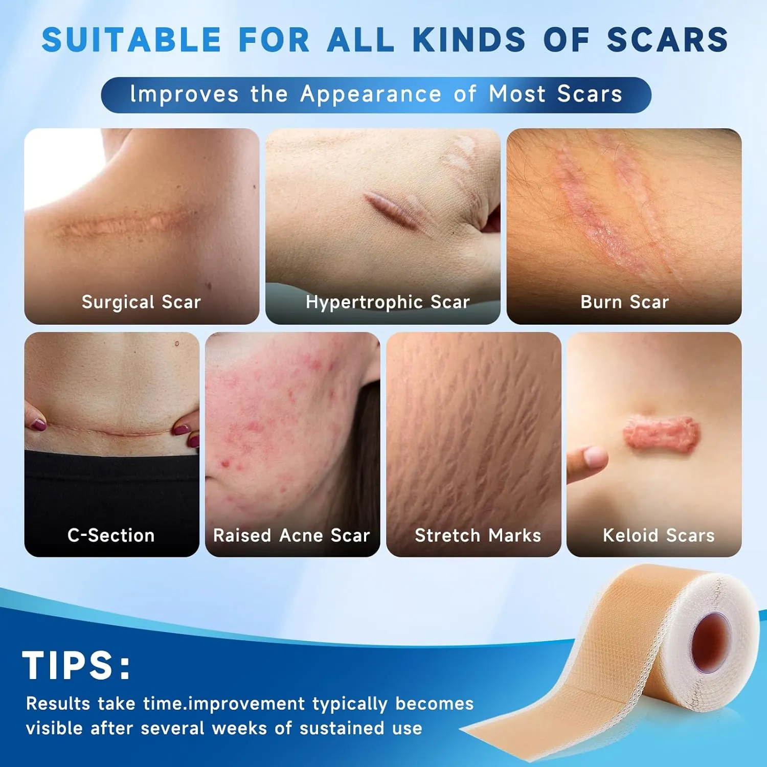 Silicone Scar Sheets, Silicone Scar Tape(1.8” x 157” Roll 4M), Silicone Scar Sheets for Surgical Scars, Keloid Bump Removal, Stretch Marks Removal, C-Section, Burn et